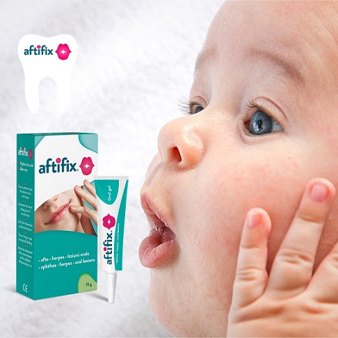 aftifix
